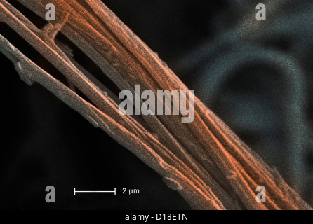 Scanning Electron Schliffbild von Asbest, 8000 x Stockfoto