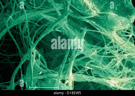 Scanning Electron Schliffbild von Asbest, 5000 x Stockfoto