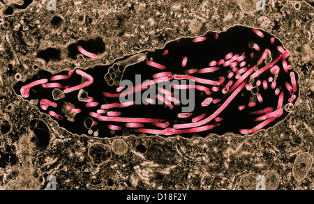 Transmission Electron Schliffbild des Ebola-virus Stockfoto