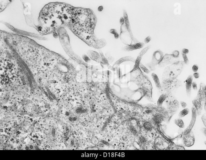 Transmission Electron Schliffbild des Ebola-virus Stockfoto