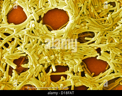 Elektron Schliffbild von Legionellen, 6500 x Stockfoto