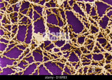 Scanning Electron Schliffbild, Leptospira Bakterien Stockfoto