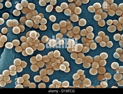 Scanning Electron Schliffbild von MRSA Stockfoto