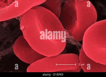 Elektron Schliffbild der roten Blutkörperchen und fibrin Stockfoto