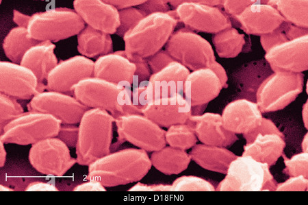 Elektron Schliffbild von Bacillus Anthracis Bakterien Stockfoto