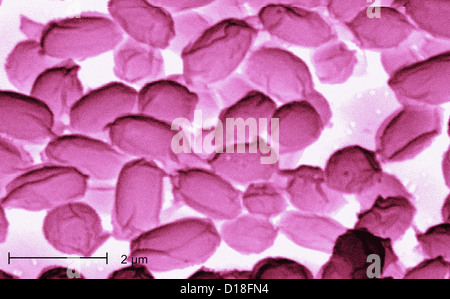 Elektron Schliffbild von Bacillus Anthracis Bakterien Stockfoto