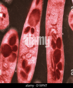 Elektron Schliffbild von Bacillus Anthracis Bakterien Stockfoto