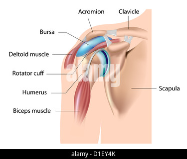 Bursa, Schulter Bursitis Stockfoto