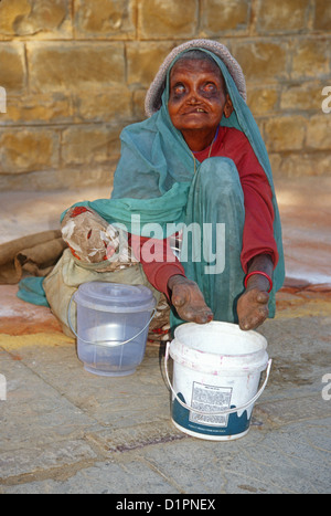 Blinde Bettler Frau mit Lepra, Jaisalmer, Rajasthan, Indien Stockfoto