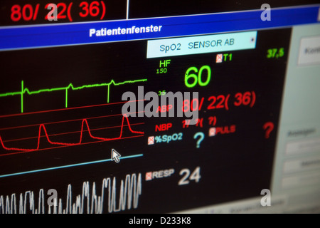 Essen, Deutschland, einem Vitalparameter-Monitor auf der Intensivstation eines Krankenhauses Stockfoto