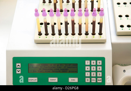 Essen, Deutschland, Messung der Erythrozyten Sedimentation Rate in einem zytologischen Labor Stockfoto