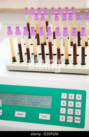 Essen, Deutschland, Messung der Erythrozyten Sedimentation Rate in einem zytologischen Labor Stockfoto