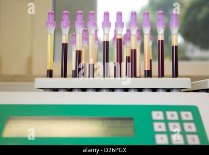 Essen, Deutschland, Messung der Erythrozyten Sedimentation Rate in einem zytologischen Labor Stockfoto