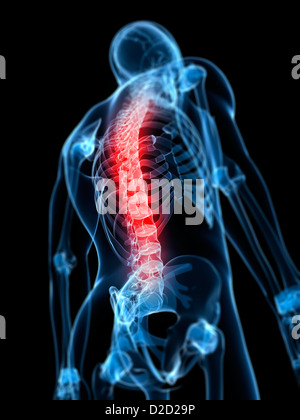 Schmerzen im Rücken konzeptionelle Computer Grafik Stockfoto