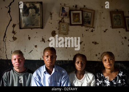 Familienbild von afrikanischen Albinos. Stockfoto