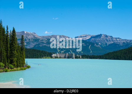 Lake Louise Area und Berge, AB, Canada Stockfoto