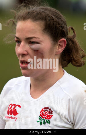 Emma Croker England Rugby-Hooker mit einem blauen Auge 2.2.2013, Esher, England V Schottland Frauen Rugby Six Nations. Stockfoto