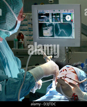 (Dpa) - mit Hilfe der neuen Navigation System für Operationen "Navigiert Control" ein Patient genannt erhält ein Zahnimplantat in der Charite Klinik in Berlin, Deutschland, 12. Januar 2005. Während der Operation das Instrument, wie Bohrer schaltet Bur oder Säge, betrieben durch den Chirurgen automatisch sich wenn sie die genauen Anweisungen von vorzeitiger Aufbau Bilddaten nicht genau verfolgt. Das ist Stockfoto