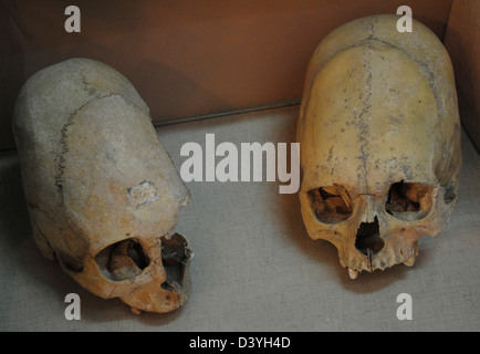 Sarmaten. Zwei deformierten menschlichen Schädeln. Wahrscheinlich datiert im 3. Jahrhundert v. Chr.. Kertsch historische und archäologische Museum. Stockfoto