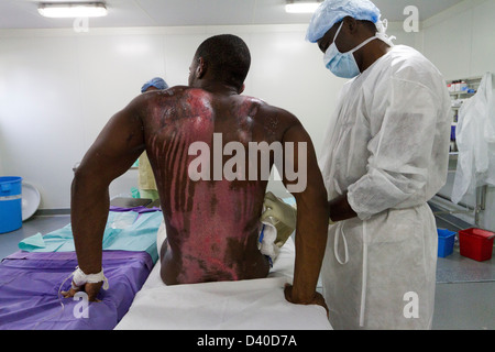 Einheit in Drouillard Krankenhaus MSF Port-au-Prince Haiti zu verbrennen Stockfoto