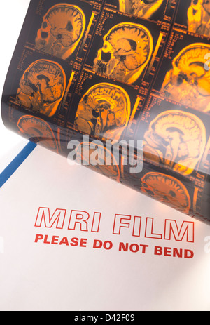 Magnetresonanztomographie (MRI) Film and Folder, USA 2013 Stockfoto