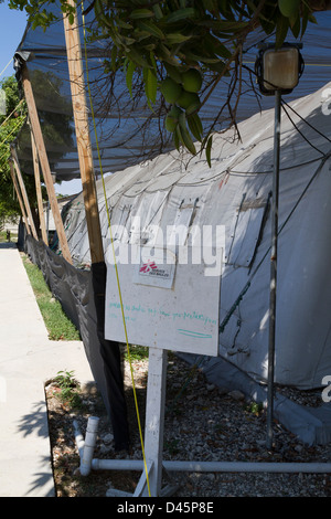 Einheit in Drouillard Krankenhaus MSF Port-au-Prince Haiti zu verbrennen Stockfoto