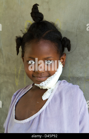 Ein junger Patient in Drouillard Krankenhaus MSF Port-au-Prince Haiti Stockfoto