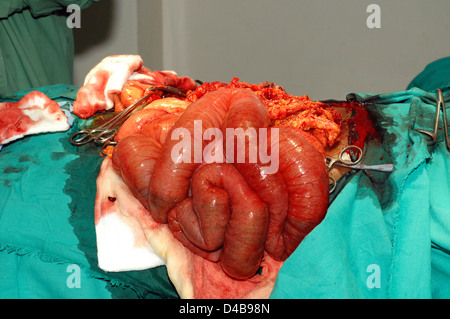 Nahaufnahme der faserige Haftung des Dickdarms. Stockfoto