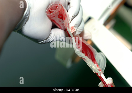 Jeder komplexe Operation kann nicht durchgeführt werden, ohne Notwendigkeit Bluttransfusion Blut gespendet freiwillige Blut alle Spender Banken wird Stockfoto