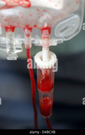 Jeder komplexe Operation kann nicht durchgeführt werden, ohne Notwendigkeit Bluttransfusion Blut gespendet freiwillige Blut alle Spender Banken wird Stockfoto