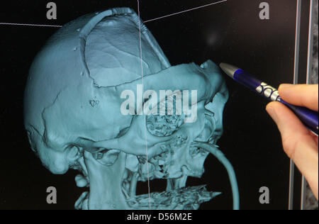 Ein medizinische Ingenieur wirft einen Blick auf das virtuelle Modell eines menschlichen Schädels mit schweren Schaden 3di GmbH in Jena, Deutschland, 15. März 2010. Daten aus ein Patient-Computer-Tomographie, die Bilder verwendet werden, um zu produzieren Glas passgenau Knochen Ersatz gemacht aus Titan, Keramik Material oder hohe Leistung Kunststoff. In Notfällen kann die patientenspezifische Knochenimplantate produ Stockfoto