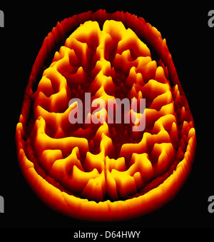 Gehirn-Scan, MRI Scan, heightmap Stockfoto