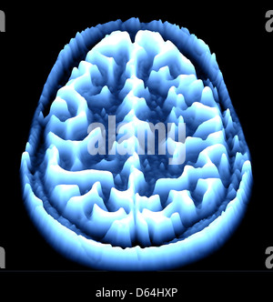 Gehirn-Scan, MRI Scan, heightmap Stockfoto