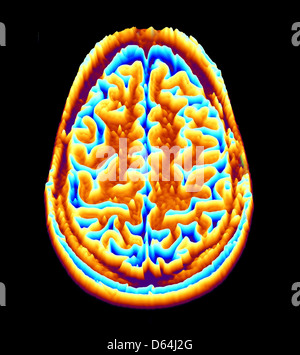 Gehirn-Scan, MRI Scan, heightmap Stockfoto