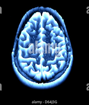 Gehirn-Scan, MRI Scan, heightmap Stockfoto