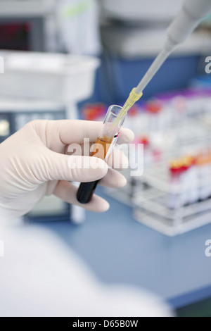 Labor, Reagenzglas, Blutprobe, pipette Stockfoto