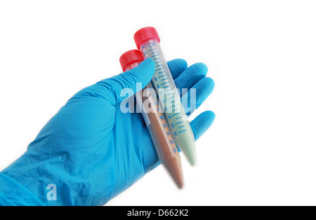 Arm im Handschuh hält Rohre mit chemischen Verbindungen im Labor Stockfoto