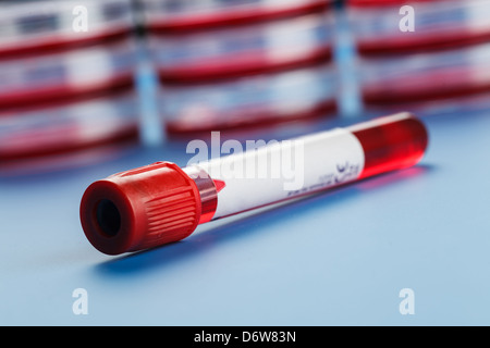 Blutprobe in einem Reagenzglas Vacutainer Stockfoto