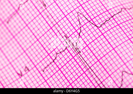 Kardiogramm Diagramm Makro Papier closeup Stockfoto