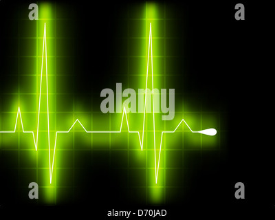 Grünes Herz schlagen Ekg-Diagramm Stockfoto