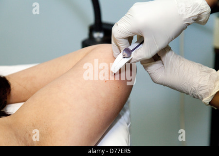 Eine Frau, die eine langfristige Verhütungsmethode Implantat setzen Sie in den Arm, Suffolk, UK Nexplanon Stockfoto