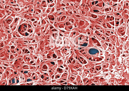 Scanning Electron Schliffbild Borrelia Burgdorferi Bakterien Stockfoto