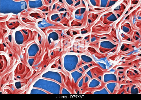 Scanning Electron Schliffbild Borrelia Burgdorferi Bakterien Stockfoto