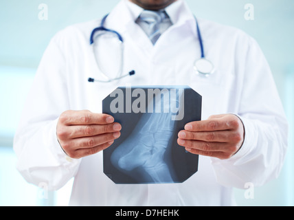 Nahaufnahme des Arztes halten Röntgenaufnahme des menschlichen Fußes Stockfoto