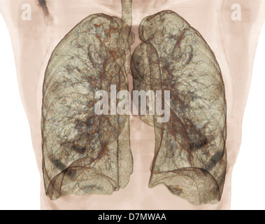 Gesunde Lungen, 3D CT-scan Stockfoto