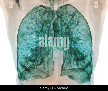 Gesunde Lungen, 3D CT-scan Stockfoto