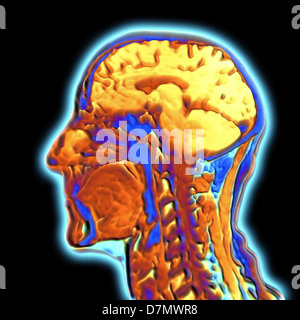 Farbige MRT-Untersuchung des menschlichen Kopfes Stockfoto