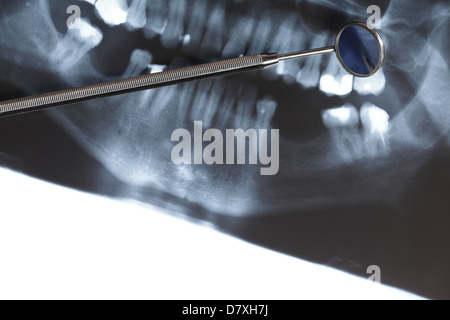 Panorama-Röntgenaufnahme Bild scannen von Menschen Zähne und Mundspiegel Stockfoto