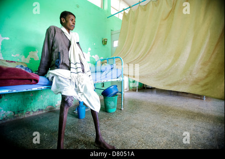 Eine junge sudanesische männlichen Erwachsenen leiden Myzetom auf das rechte Knie. Stockfoto