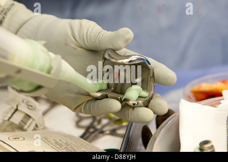 Knie-TEP Operation in einem Krankenhaus-Theater total Stockfoto